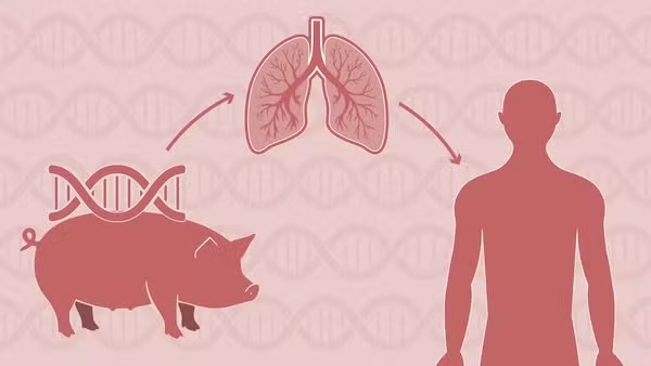 Leia mais sobre o artigo Pulmão de porco funciona nove dias em xenotransplante humano pioneiro