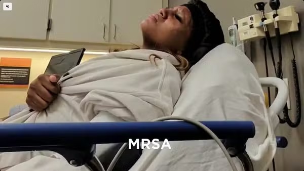 Leia mais sobre o artigo Atleta contrai MRSA necrosante após mergulho em piscina de hotel nos EUA