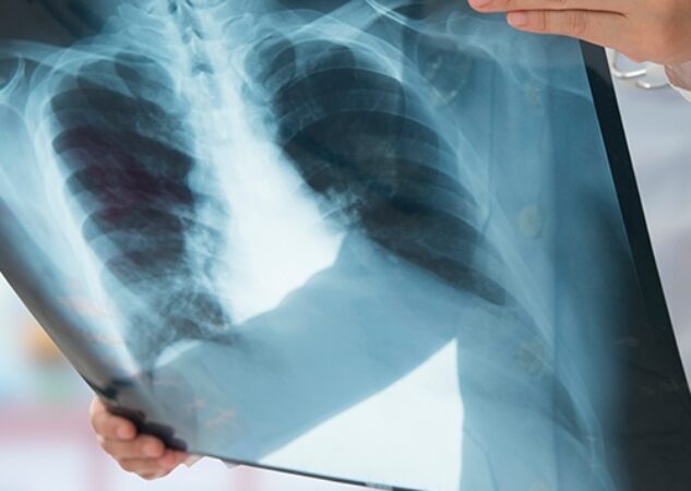 Prefeitura de Goiânia amplia e moderniza diagnóstico precoce de doenças pulmonares com teste de genotipagem