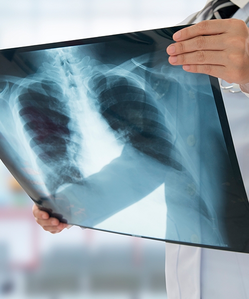 Leia mais sobre o artigo Prefeitura de Goiânia amplia e moderniza diagnóstico precoce de doenças pulmonares